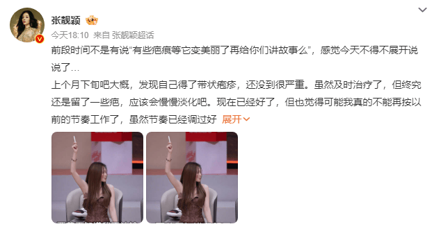 如何代理皇冠信用网
_张靓颖发长文谈身体状况如何代理皇冠信用网
，自曝得带状疱疹、旧伤复发，取消跨年演唱会加场计划