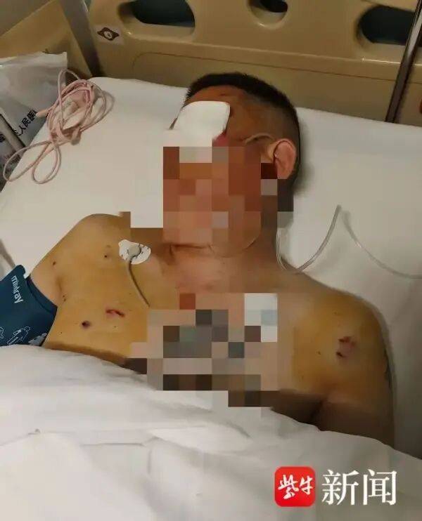 体斯輀必箭v克拉门扞国王
_男子取170万元现金银行门口遭抢体斯輀必箭v克拉门扞国王
，工作人员无动于衷