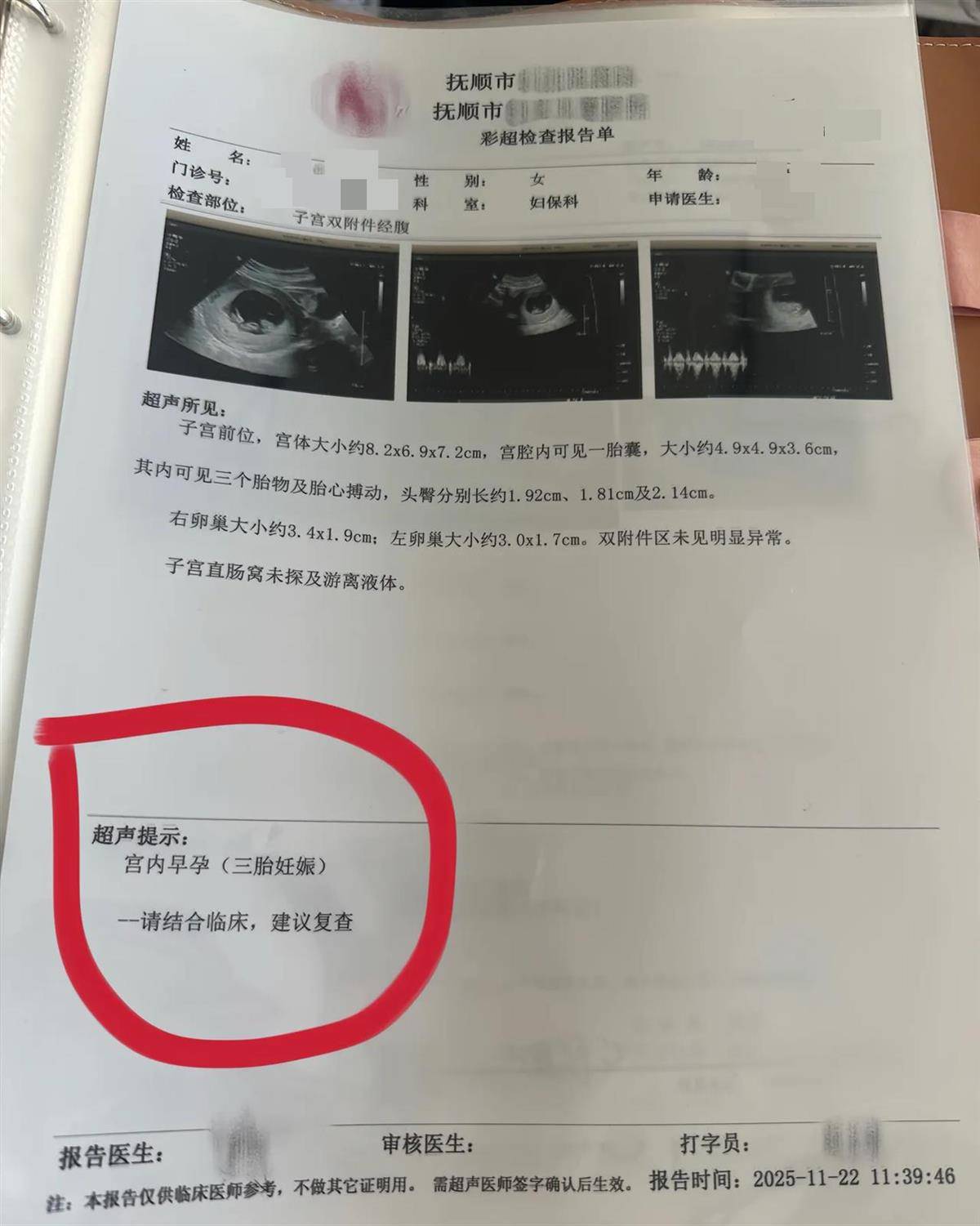 怎么开通皇冠信用开户_辽宁一孕妇两个月内从一胎变四胞胎怎么开通皇冠信用开户，每次产检发现多出一胎，医生：系同卵四胞胎，概率1300万至1500万分之一