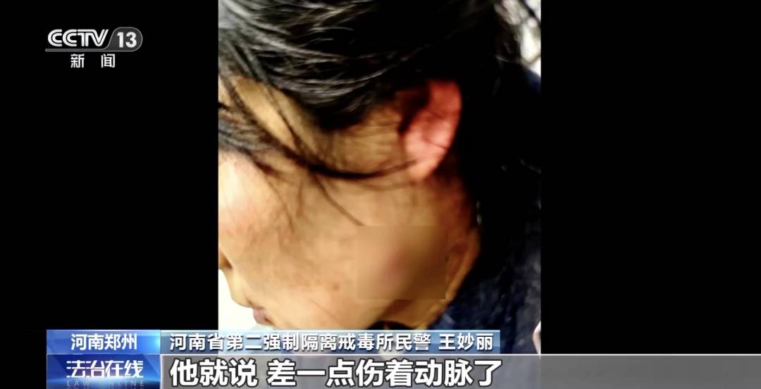 皇冠信用盘注册
_女警徒手夺刀皇冠信用盘注册
,脸上缝30多针:后怕但不后悔